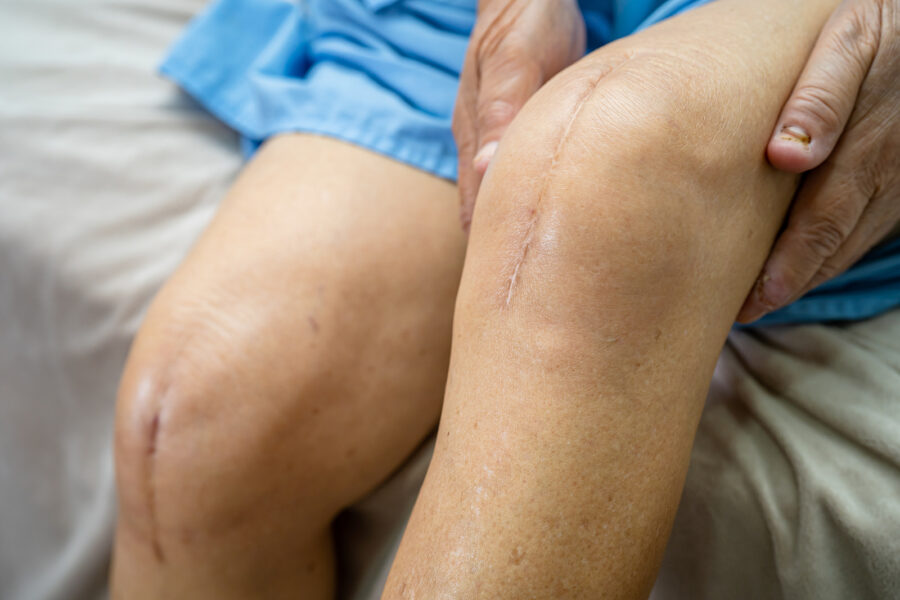 Senior Scarring: Personal Care at Home Oakland PA